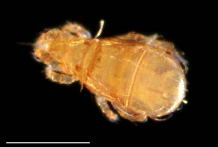 ナガヒワダニ属の1種 （Eohypochthonius sp.）