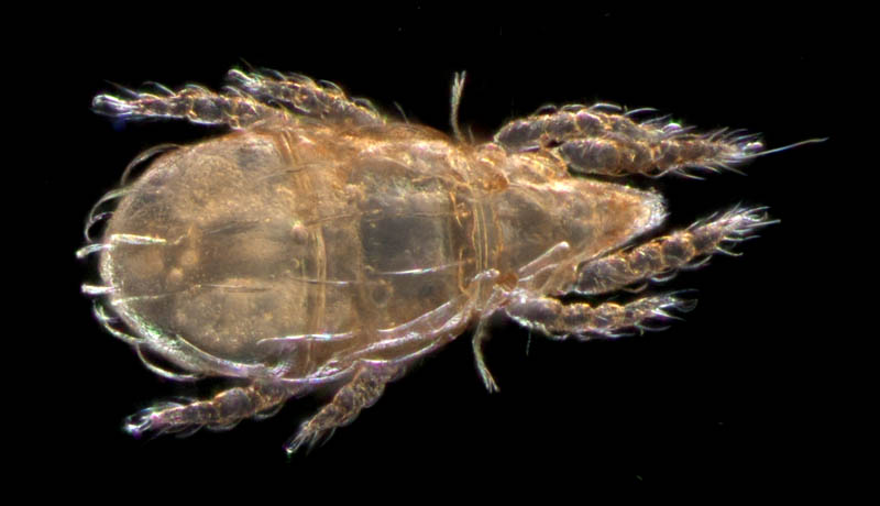 ナガヒワダニ属の1種 （Eohypochthonius sp.）