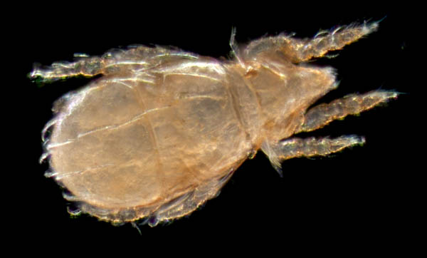 ナガヒワダニ属の1種 （Eohypochthonius sp.）