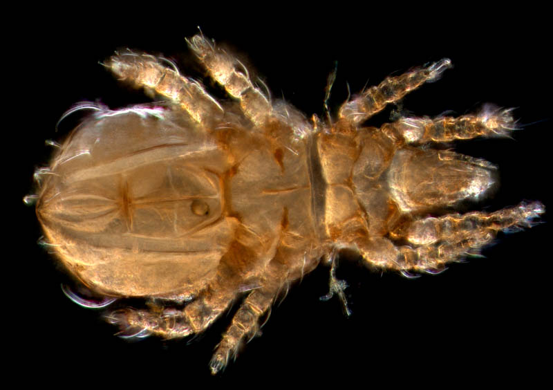 ナガヒワダニ属の1種 （Eohypochthonius sp.）