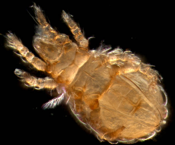 ナガヒワダニ属の1種 （Eohypochthonius sp.）