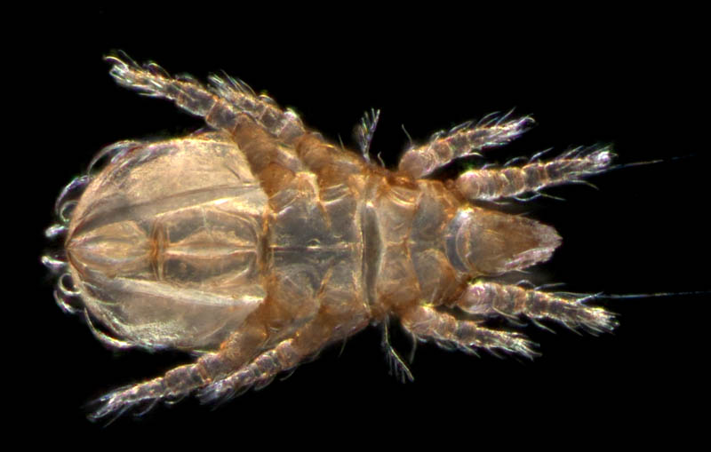 ナガヒワダニ属の1種 （Eohypochthonius sp.）