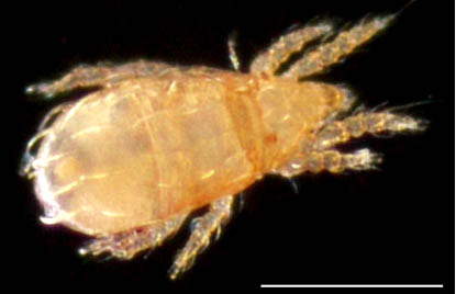 ナガヒワダニ属の1種 （Eohypochthonius sp.）