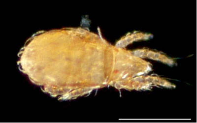 ナガヒワダニ属の1種 （Eohypochthonius sp.）