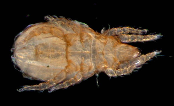 ナガヒワダニ属の1種 （Eohypochthonius sp.）