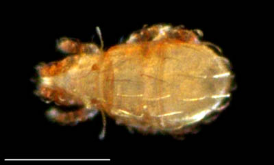 ナガヒワダニ属の1種 （Eohypochthonius sp.）