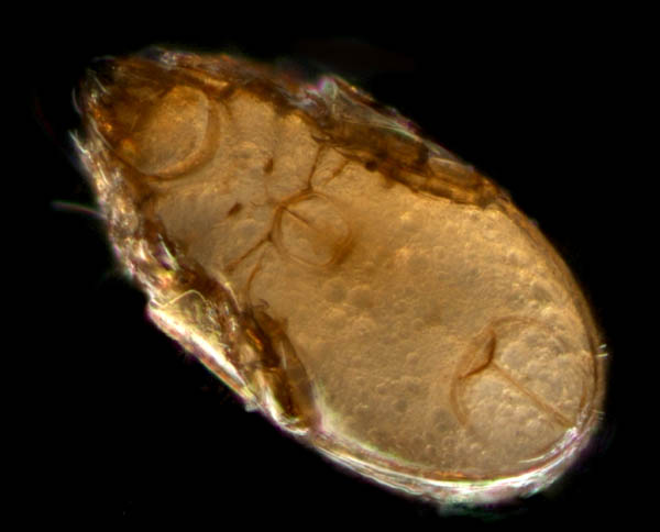 タイラナガコソデダニ（Protoribates taira）