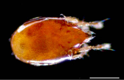 ナガコソデダニ属の1種 （Protoribates sp.)