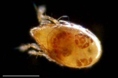 ナガコソデダニ属の1種 （Protoribates sp.)