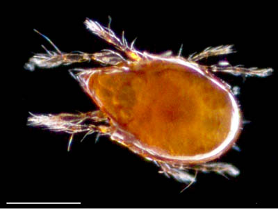 ナガコソデダニ属の1種 （Protoribates sp.)