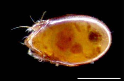 ナガコソデダニ属の1種 （Protoribates sp.)