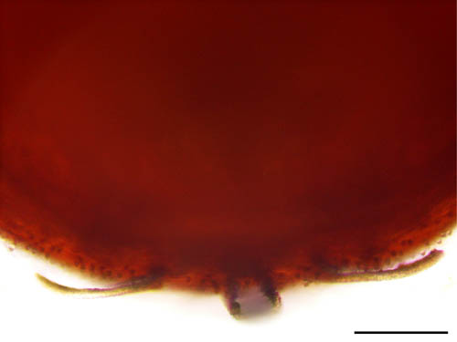 スネナガダニ属の1種 (Allodamaeus sp. )