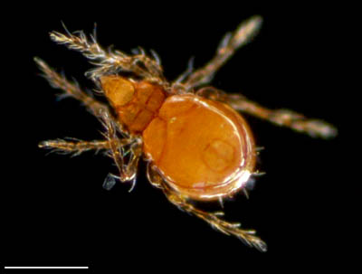 ツブダニ科(Oppiidae)の１種