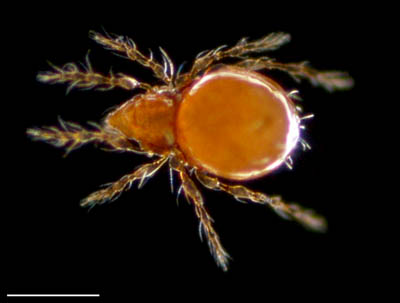 ツブダニ科(Oppiidae)の１種