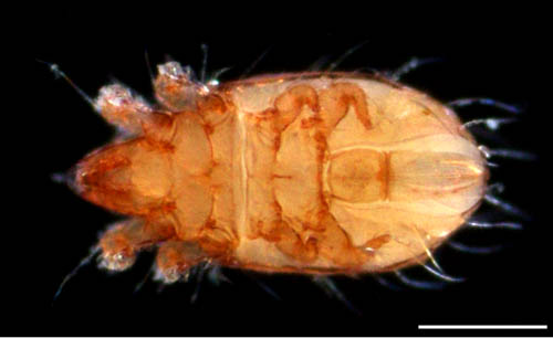 フトツツハラダニ属の1種 (Mixacarus sp.)