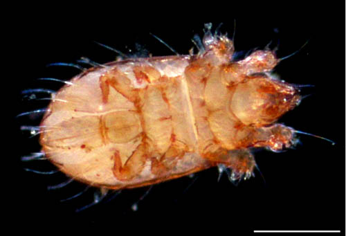 フトツツハラダニ属の1種 (Mixacarus sp.)