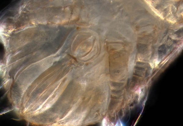 フトツツハラダニ属の1種 (Mixacarus sp.)