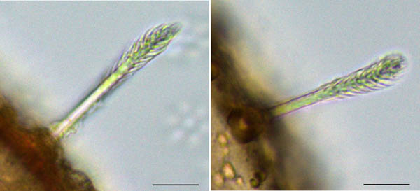 ホシモンマルノコダニ(Mixozercon stellifer)