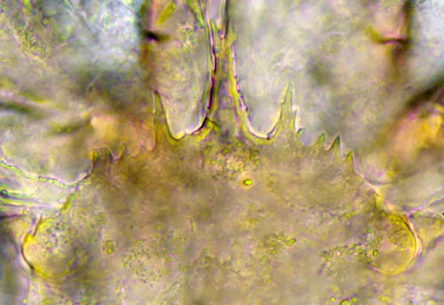 ホシモンマルノコダニ(Mixozercon stellifer)