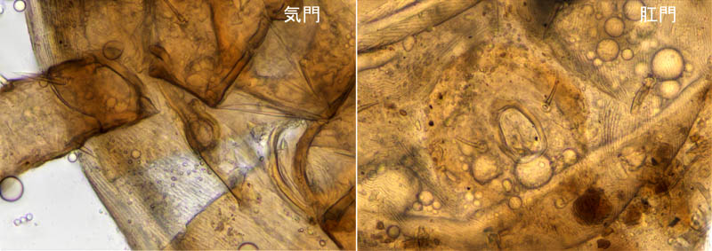 ホソトゲダニ属の1種（Hypoaspis sp.）