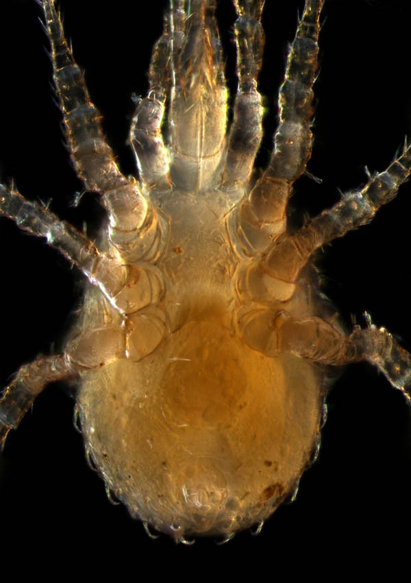 ホソトゲダニ属の1種（Hypoaspis sp.）