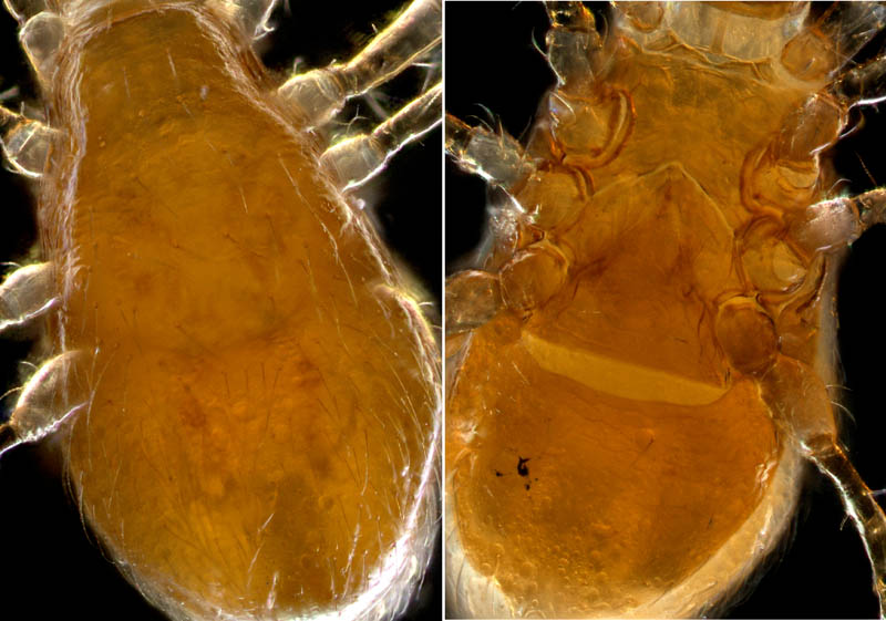 ヤドリダニ科（Parasitidae）の１種