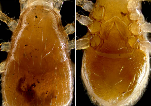 ヤドリダニ科（Parasitidae）の１種