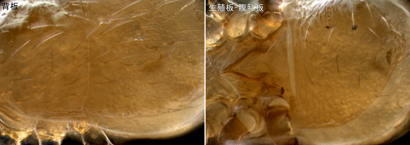 ヤドリダニ科（Parasitidae）の１種