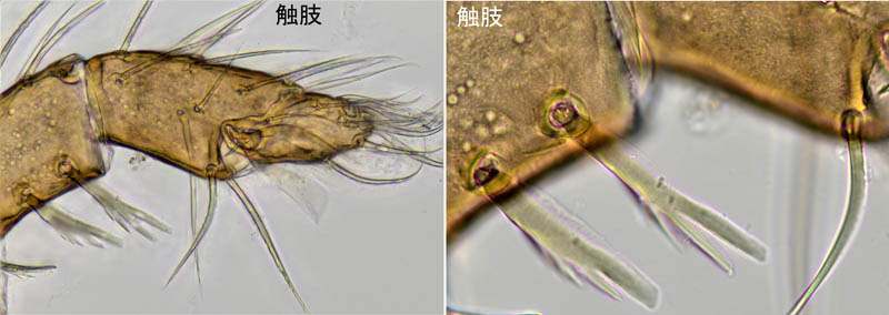 ヤドリダニ科（Parasitidae）の１種