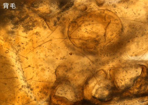 ヤドリダニ科（Parasitidae）の１種