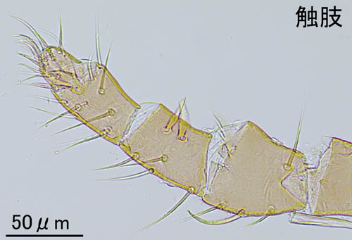 ヤドリダニ科（Parasitidae）の１種