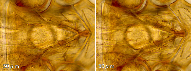 ヤドリダニ科（Parasitidae）の１種