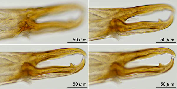 ヤドリダニ科（Parasitidae）の１種