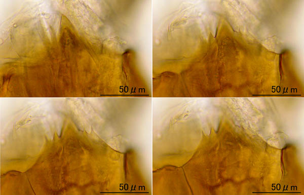 ヤドリダニ科（Parasitidae）の１種