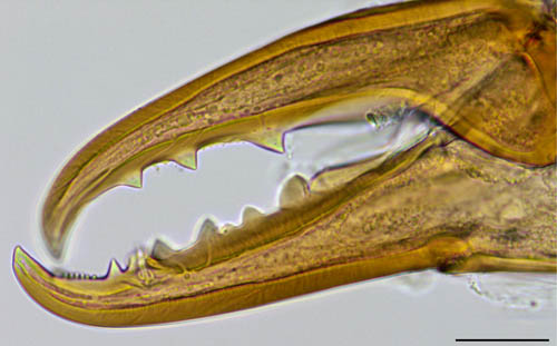 ヤドリダニ科（Parasitidae）の１種