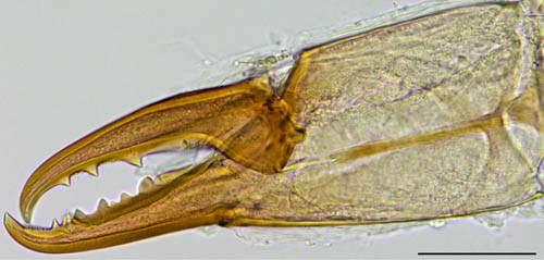 ヤドリダニ科（Parasitidae）の１種