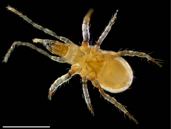 ヤドリダニ科（Parasitidae）の１種