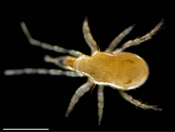 ヤドリダニ科（Parasitidae）の１種