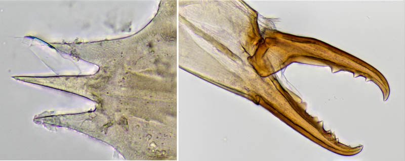 ヤドリダニ科（Parasitidae）の１種