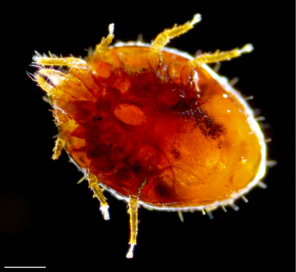 タマゴイトダニ属の１種？ (Uroobovella sp.)