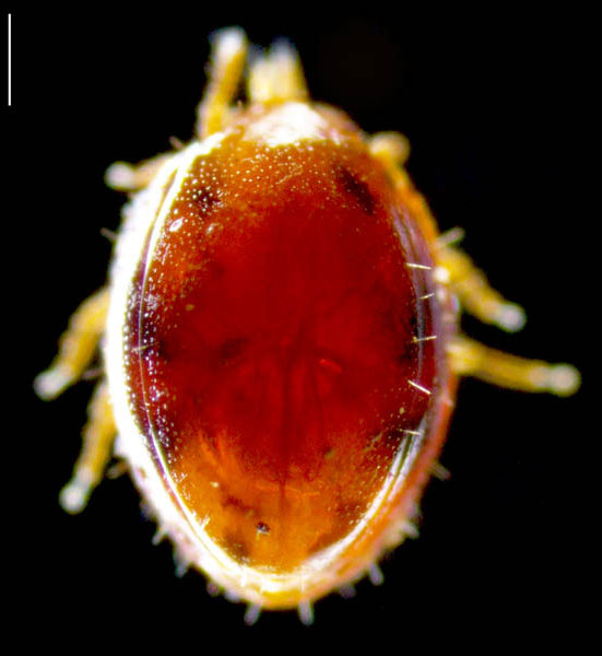 タマゴイトダニ属の１種？ (Uroobovella sp.)