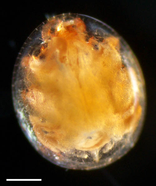 イトダニ科(Uropodidae)の１種