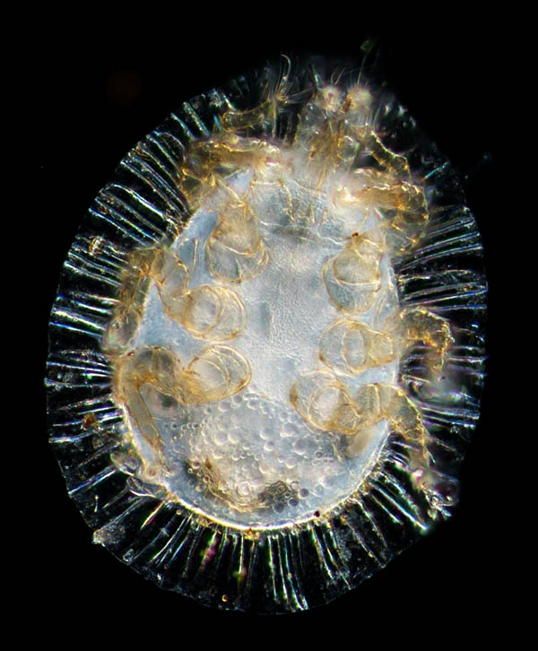 イトダニ科(Uropodidae)の１種