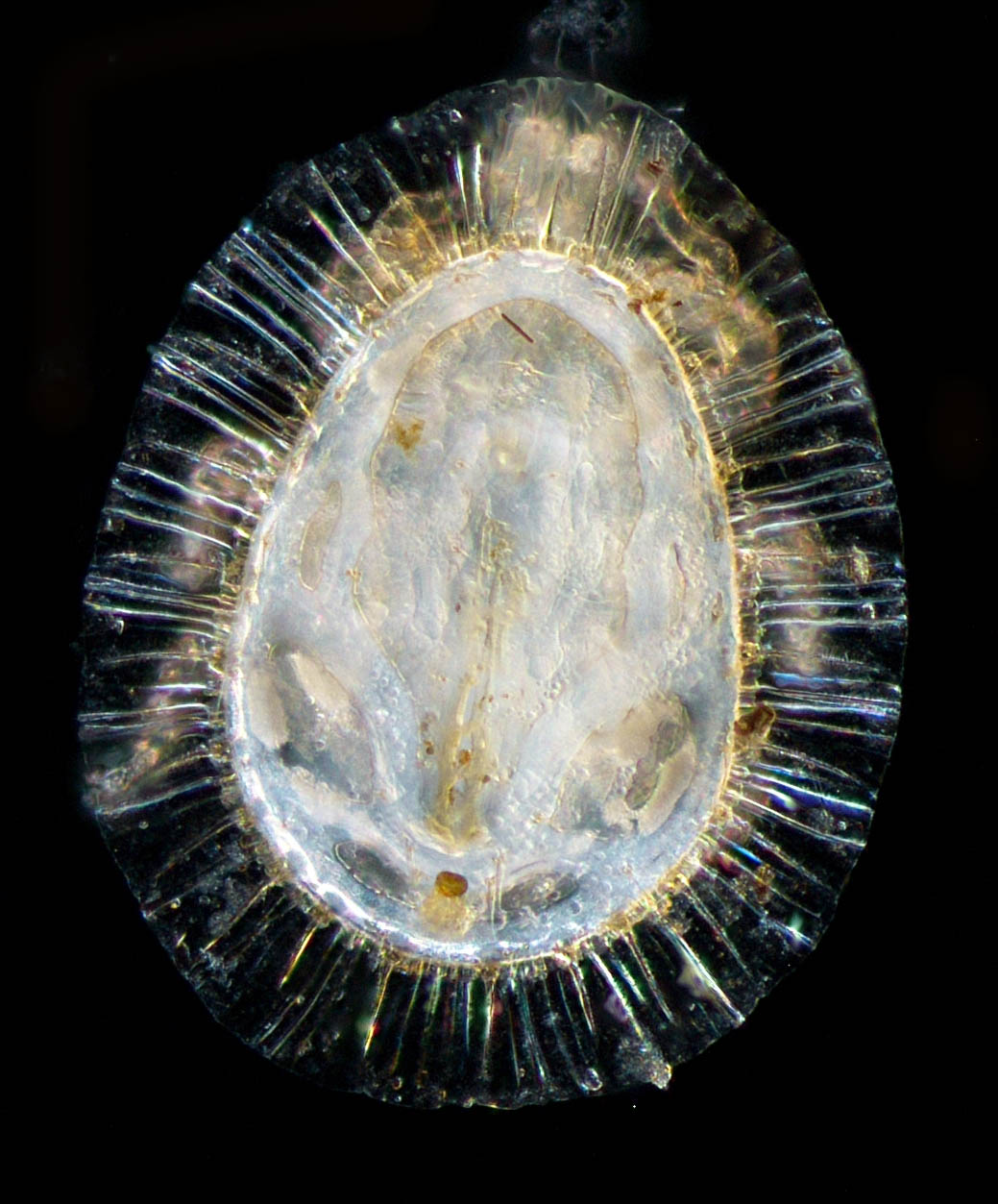 イトダニ科(Uropodidae)の１種