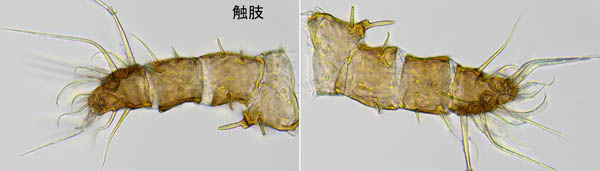 イトダニ科(Uropodidae)の１種