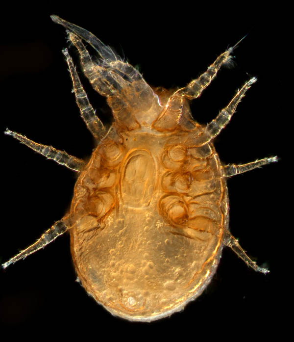 イトダニ科(Uropodidae)の１種