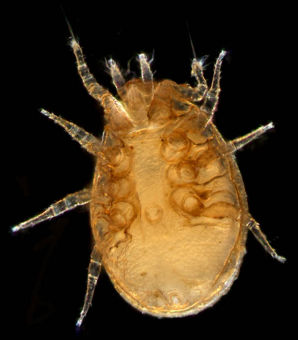 イトダニ科(Uropodidae)の１種