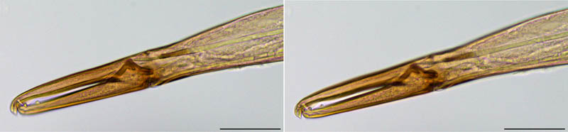 トゲダニ亜目の1種