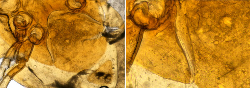 ダルマダニ科（Pachylaelapidae）の1種