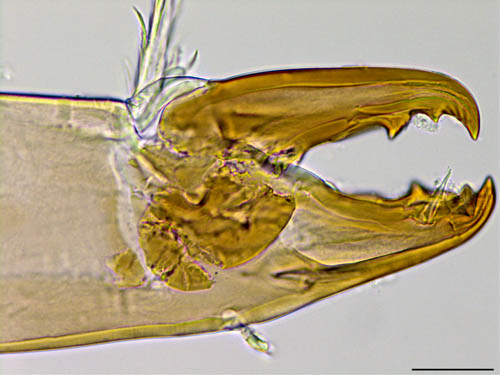 ハエダニ属の1種 (Macrocheles sp.C)